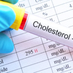 strankycinskemediciny-zvyseny-cholesterol